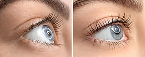 Wimperlift